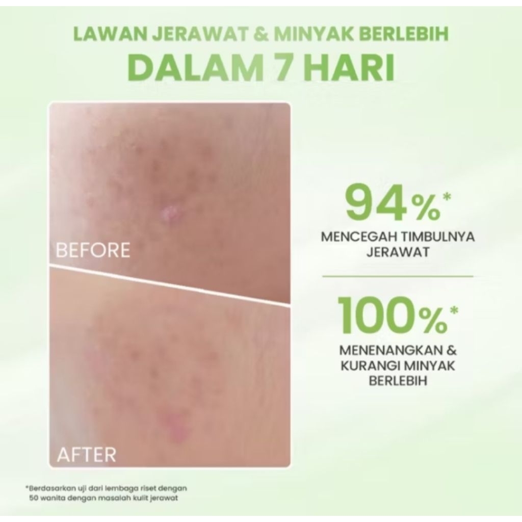 Hanasui Acne Expert Paket Lengkap - Cream Spot Gel Krim Siang Malam