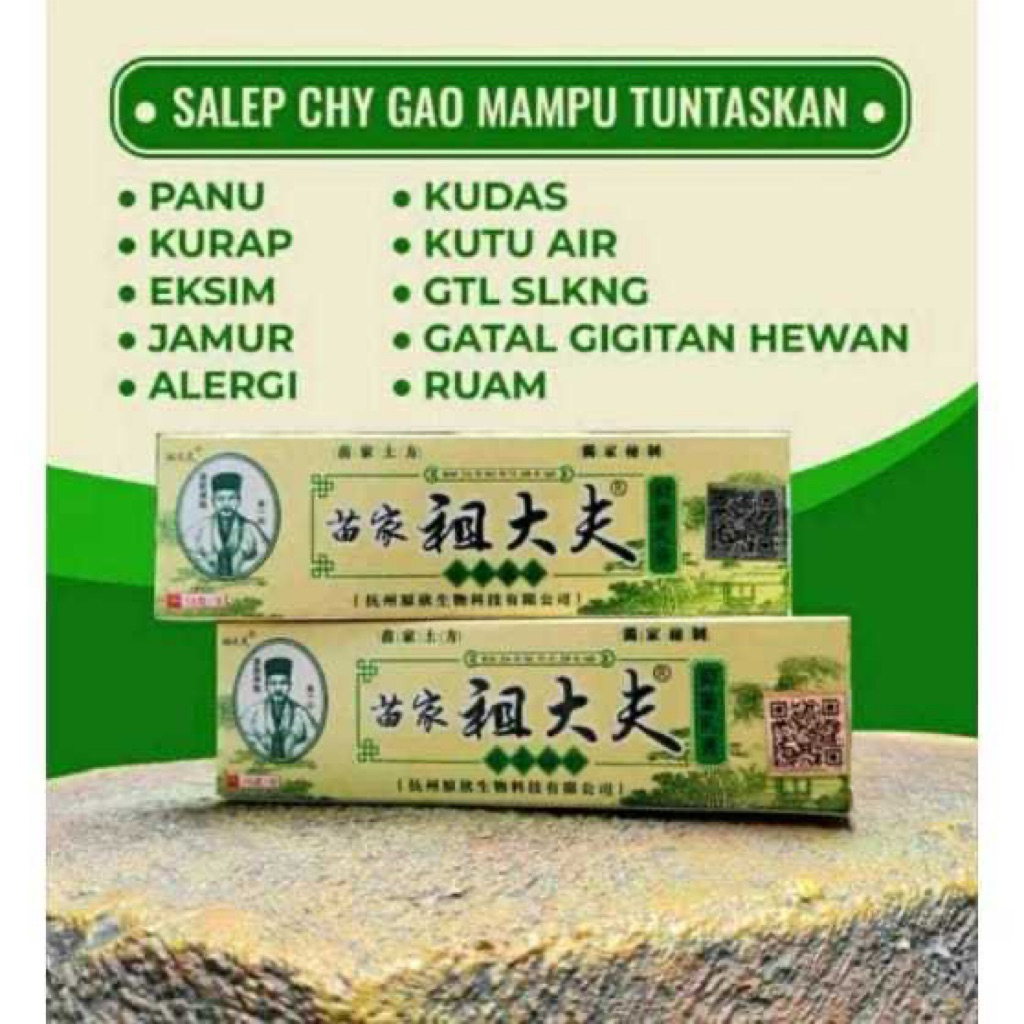 Salap gatal/alergi China