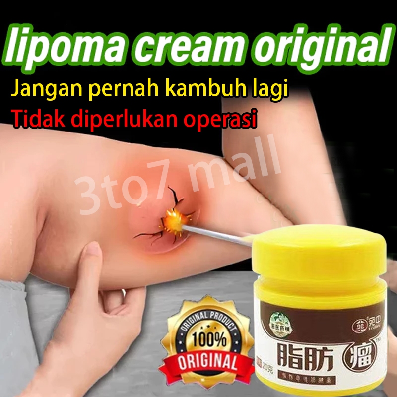 lipoma cream original Salep Obat Cream Lipoma Penghilang Lemak removal Benjolan 20g lipoma removal c