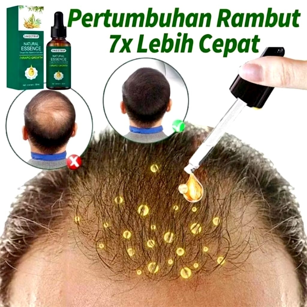 SERUM RAMBUT BOTAK / SERUM PENUMBUH RAMBUT DAN BULU