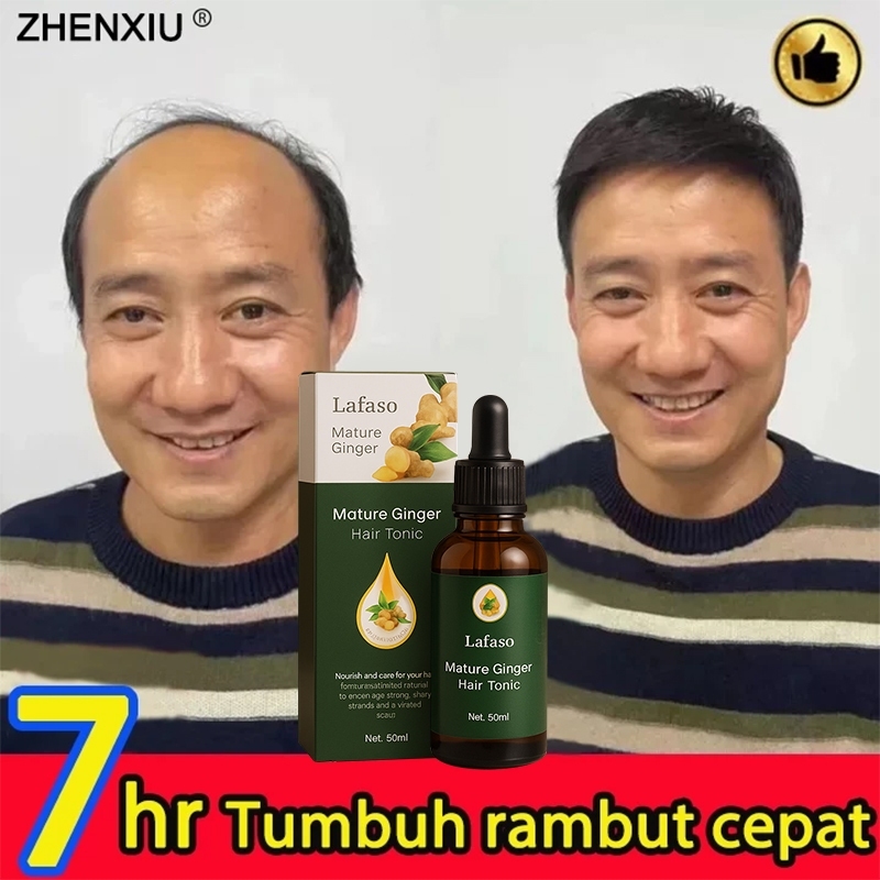 hair tonic-penumbuh rambut botak Menyehatkan Kulit Kepala&Meningkatkan Regenerasi Rambut/serum penum