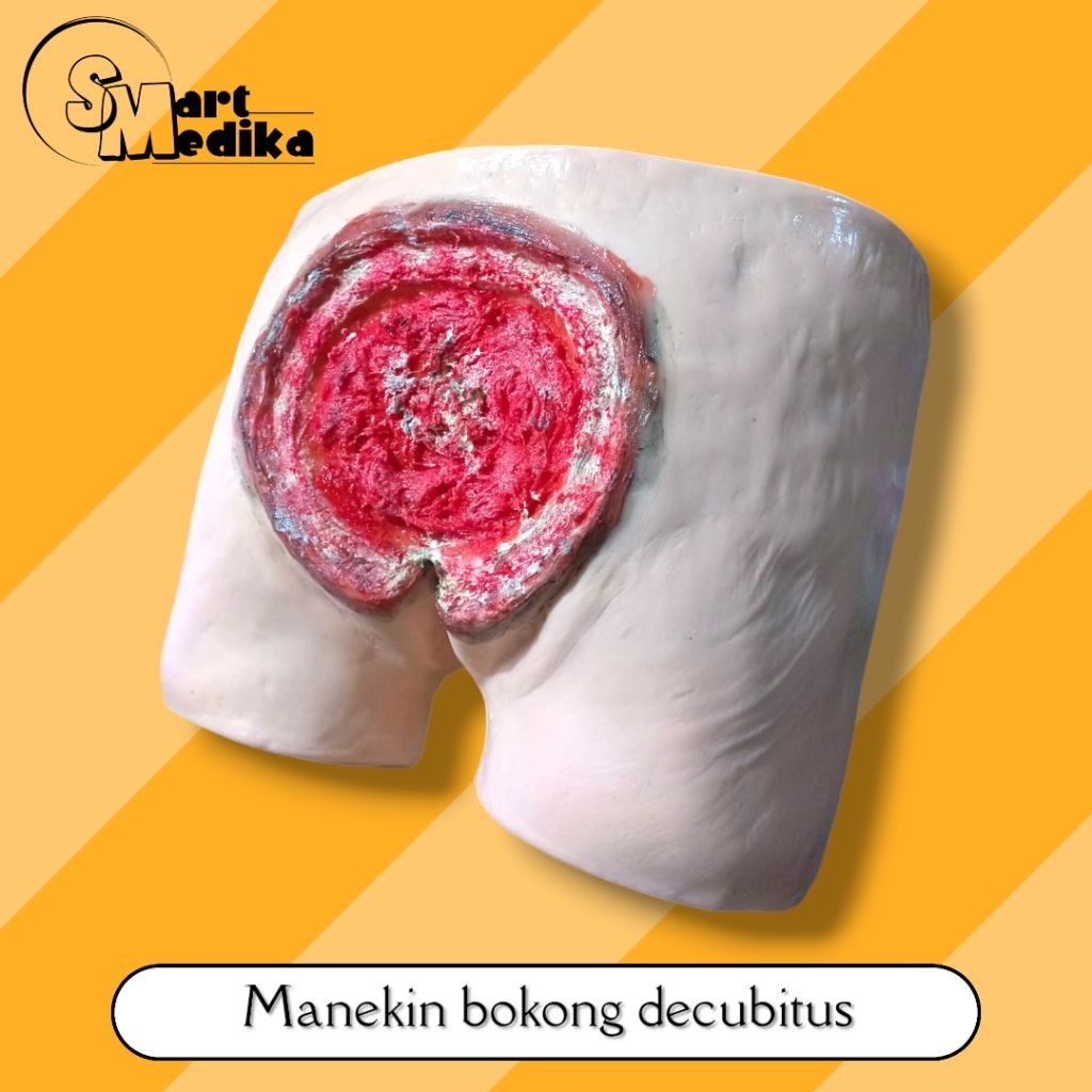 PHANTOM MANEKIN BOKONG DECUBITUS / MANIKIN BOKONG LUKA DECUBITUS