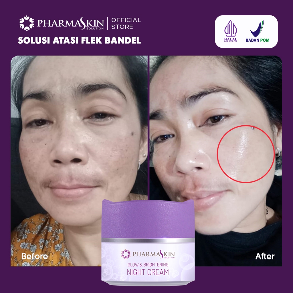 Night Cream Flek By Pharmaskin Solution | Cream Untuk Flek Hitam | Krim Untuk Plek Hitam Membandel