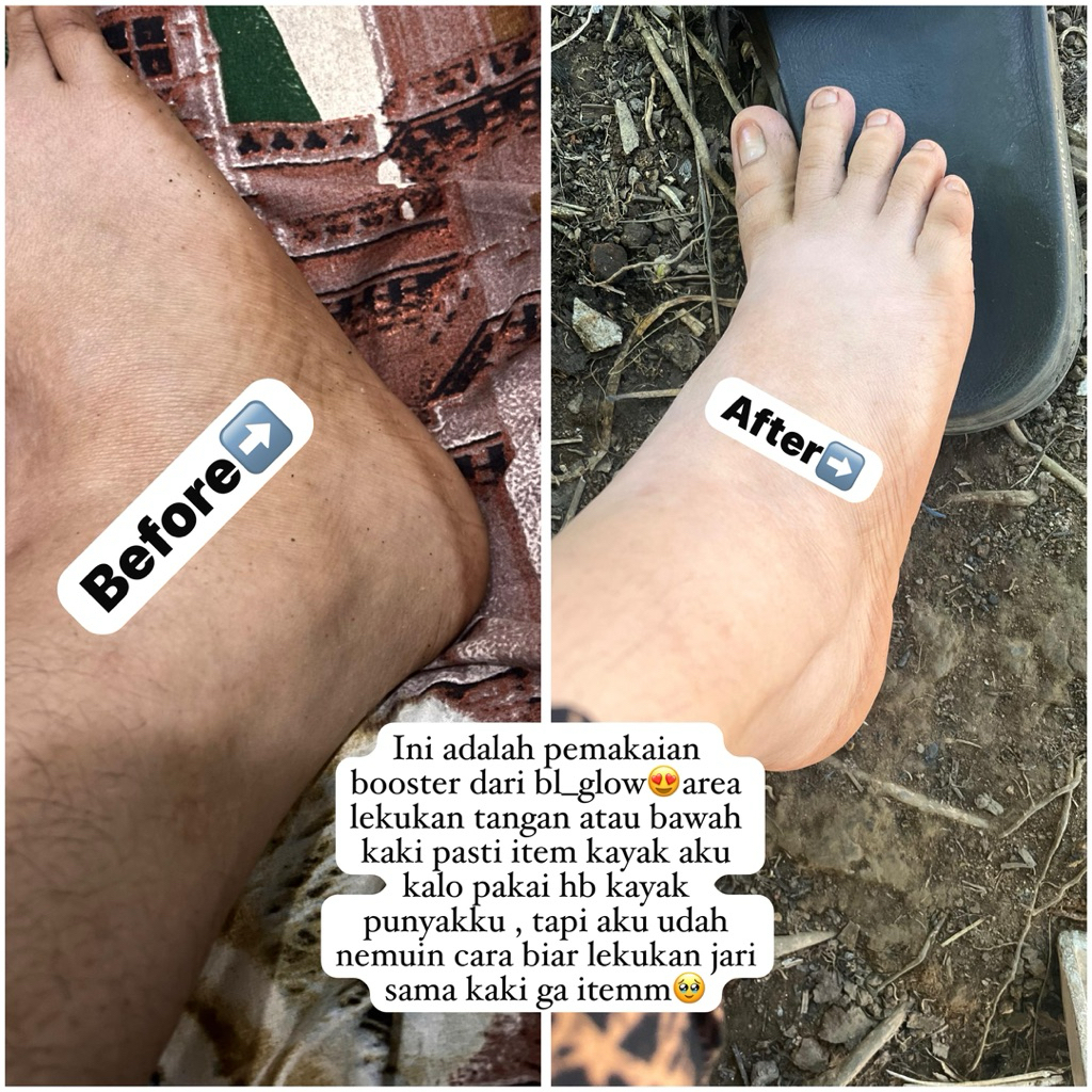 BODY BUTTER//BIBIT PEMUTIH BADAN BL_GLOW