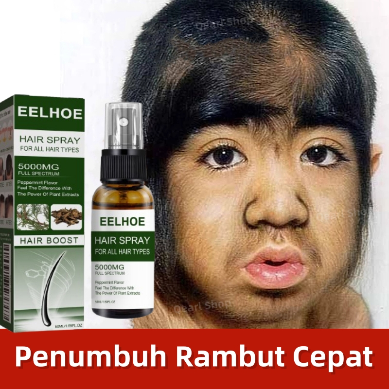 Penumbuh Rambut Cepat Dan Tebal  Serum Rambut Rontok Penebal Rambut Hair Growth Serum obat penumbuh 