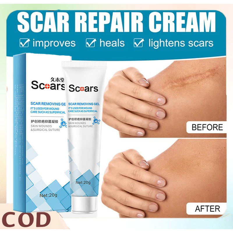 Penghilang bekas gigitan nyamuk Penghilang bekas luka hitam koreng Penghilang bekas luka/Keloid