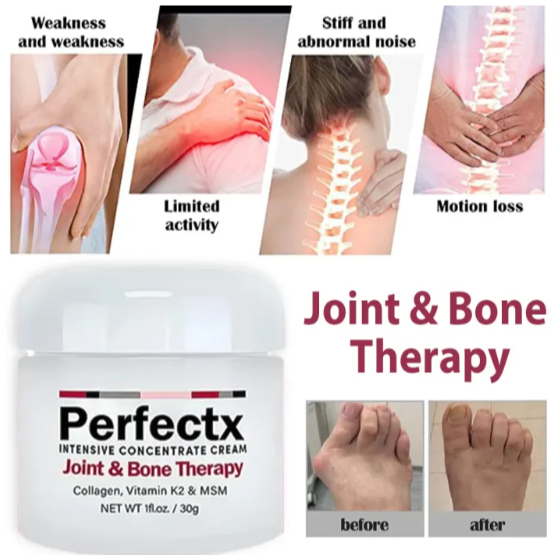 PERFECTX Joint Bone Therapy Perfectx Intensive Concentrate Cream Krim Pengobatan Asam Urat Perfectx 
