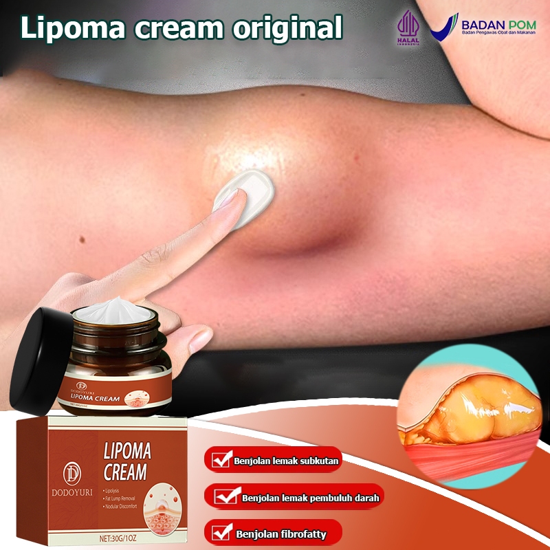 Salep lipoma salep benjolan Lipoma cream salep benjolan Obat lipoma Salep benjolan lipoma Salep benj