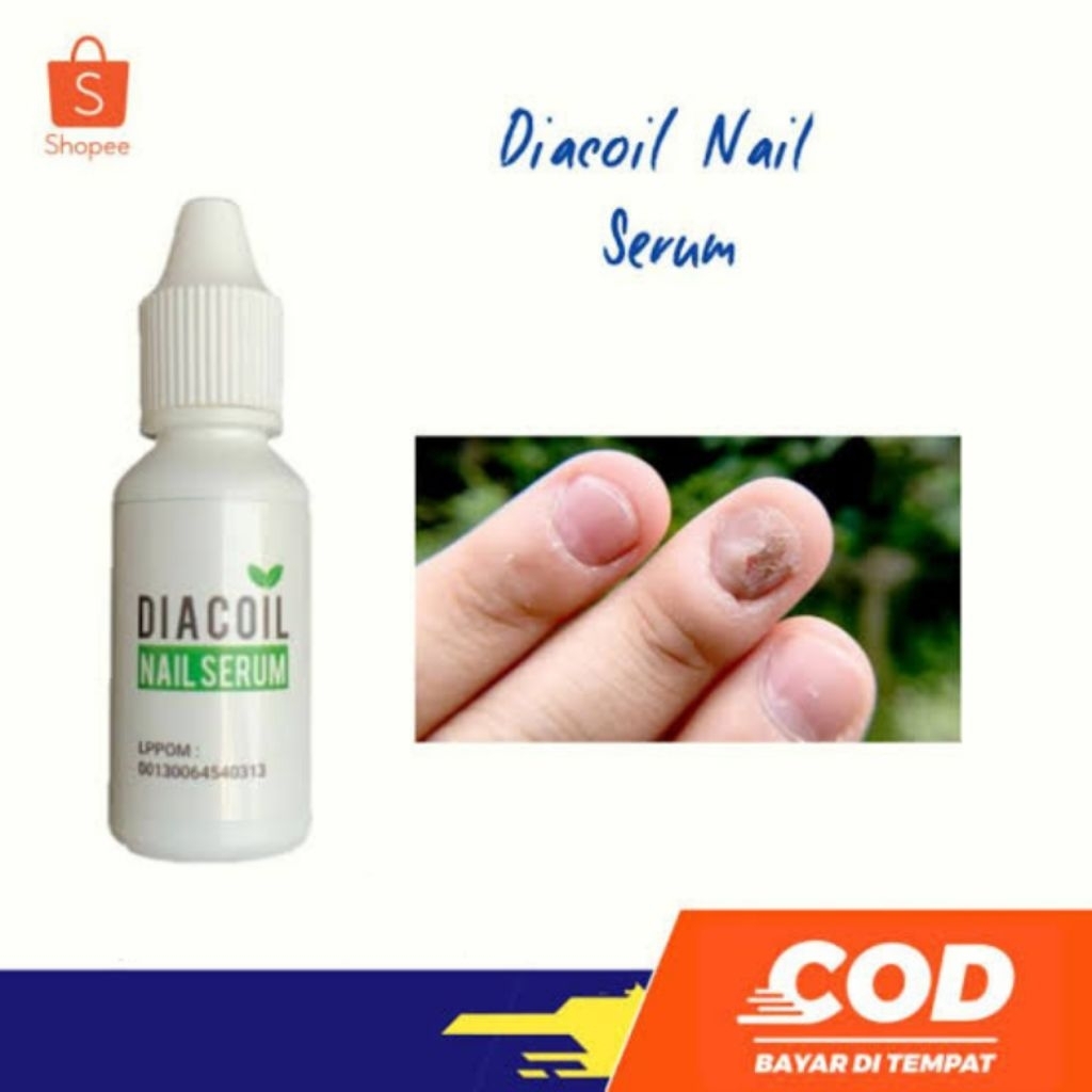 Diacoil Nail Serum Original Penghilang Kuku Rusak Cantengan Bernanah Kutikula Nail Art Penumbuh Kuku
