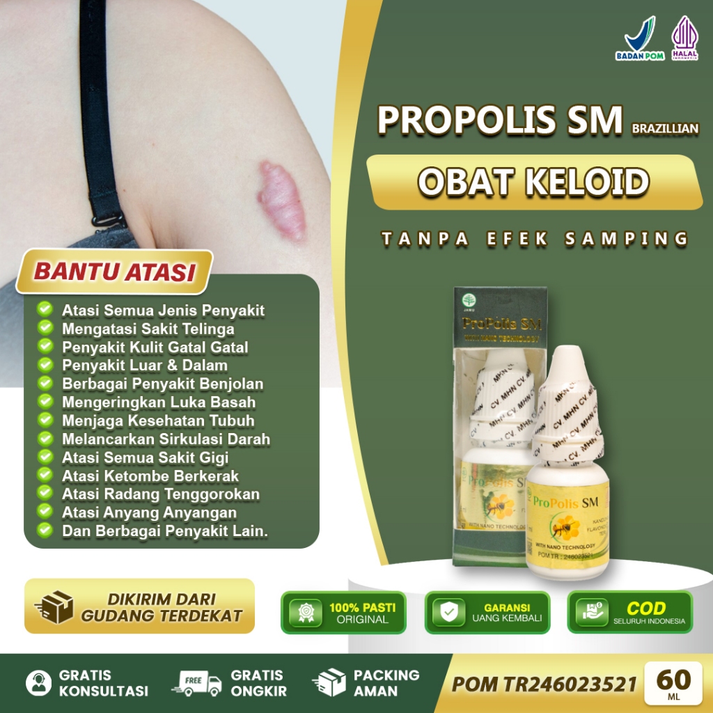 Obat Propolis SM untuk Penghilang Keloid Menonjol