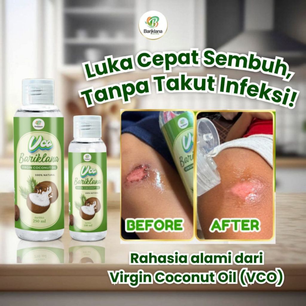

Virgin Coconut Oil ( Vco) bariklana / minyak klentik/ minyak serbaguna