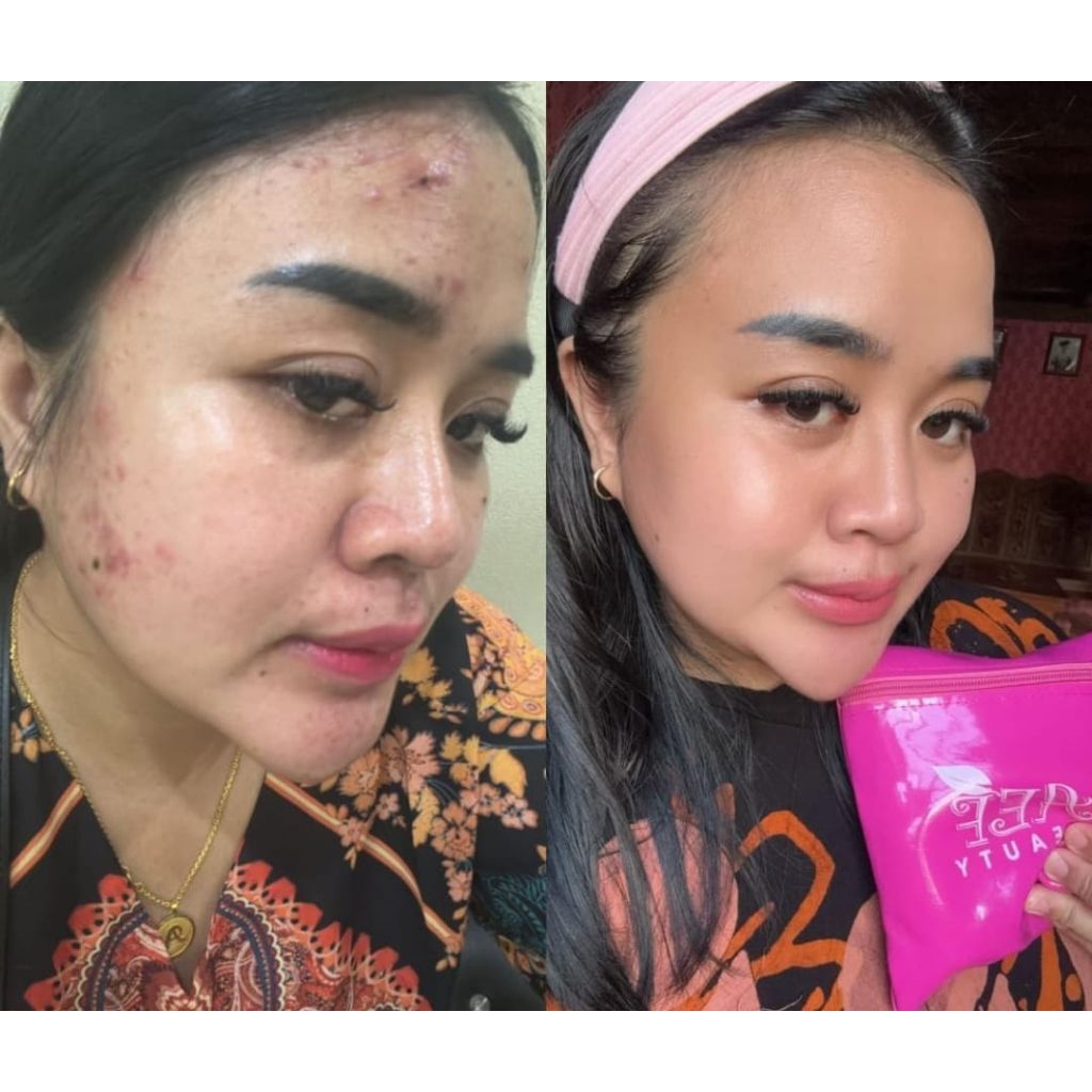 Cream AEF SKINCARE