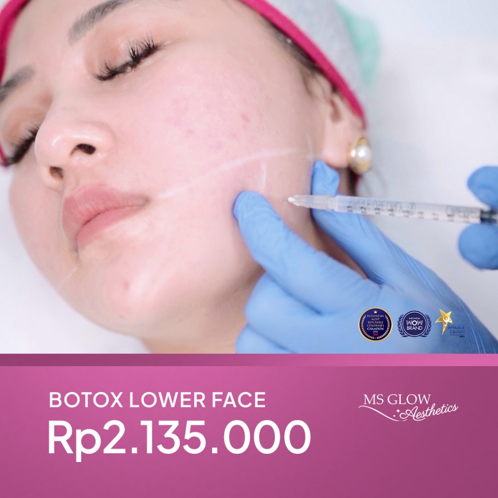 MS Glow Clinic Botox Lower Face Korea