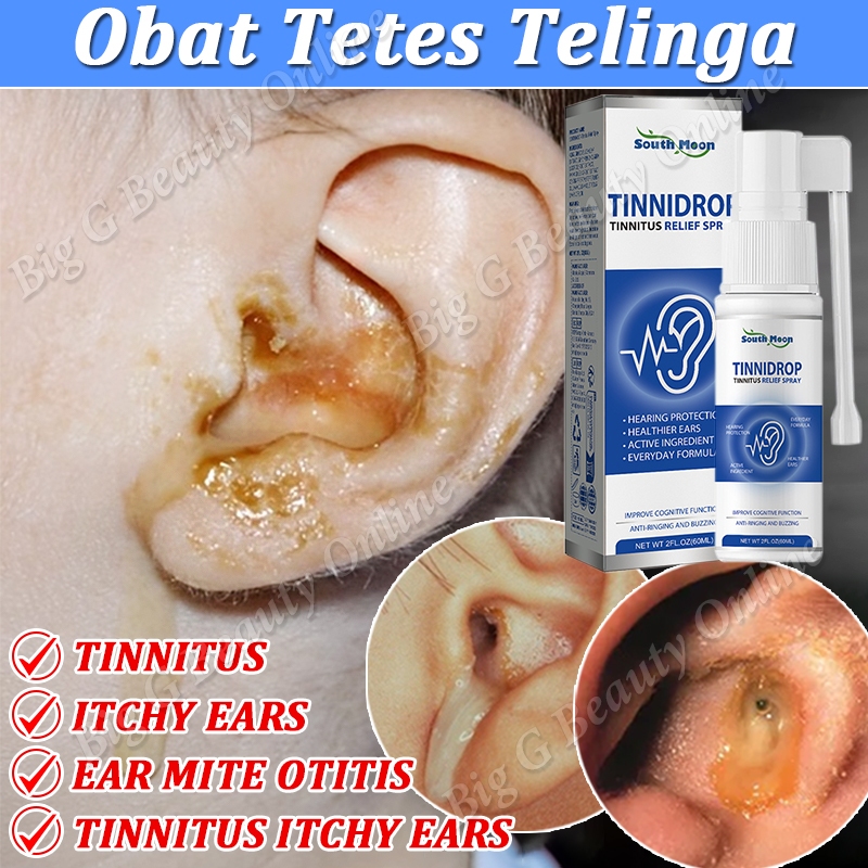 Obat Tetes Telinga Tinnitus Relief Spray Telinga Pembersih Kotoran Telinga Bernanah Meredakan Sakit 