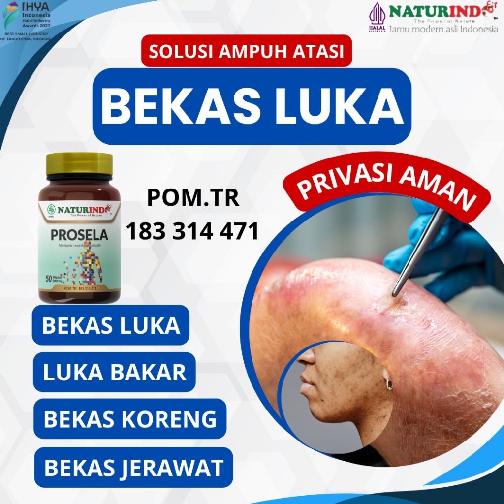 Obat Bekas Luka Bekas Koreng Bekas Jerawat Luka Bakar Operasi Prosela Herbal Naturindo