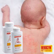 Herocyn Baby Powder Bedak Gatal Bayi anak