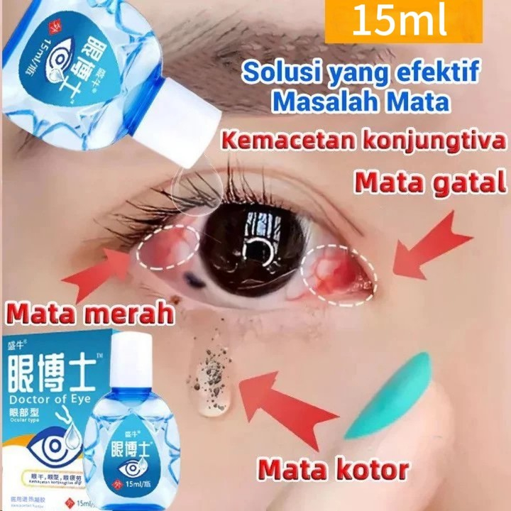 Mata Kering, Mata Perih, Mata Tersumbat, Mata Kabur Dan Bengkak, Obat Tetes Mata Mata Kering, Kemera