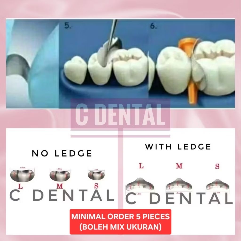 Dental Posterior Proximal Metal Matrix With Ledge / No Ledge