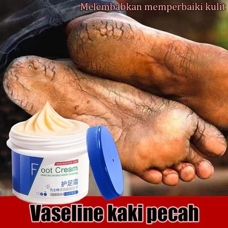 kaki pecah dan kering Foot cream Obat kaki pecah Pelembab kaki kering dan pecah Penghalus kaki kasar