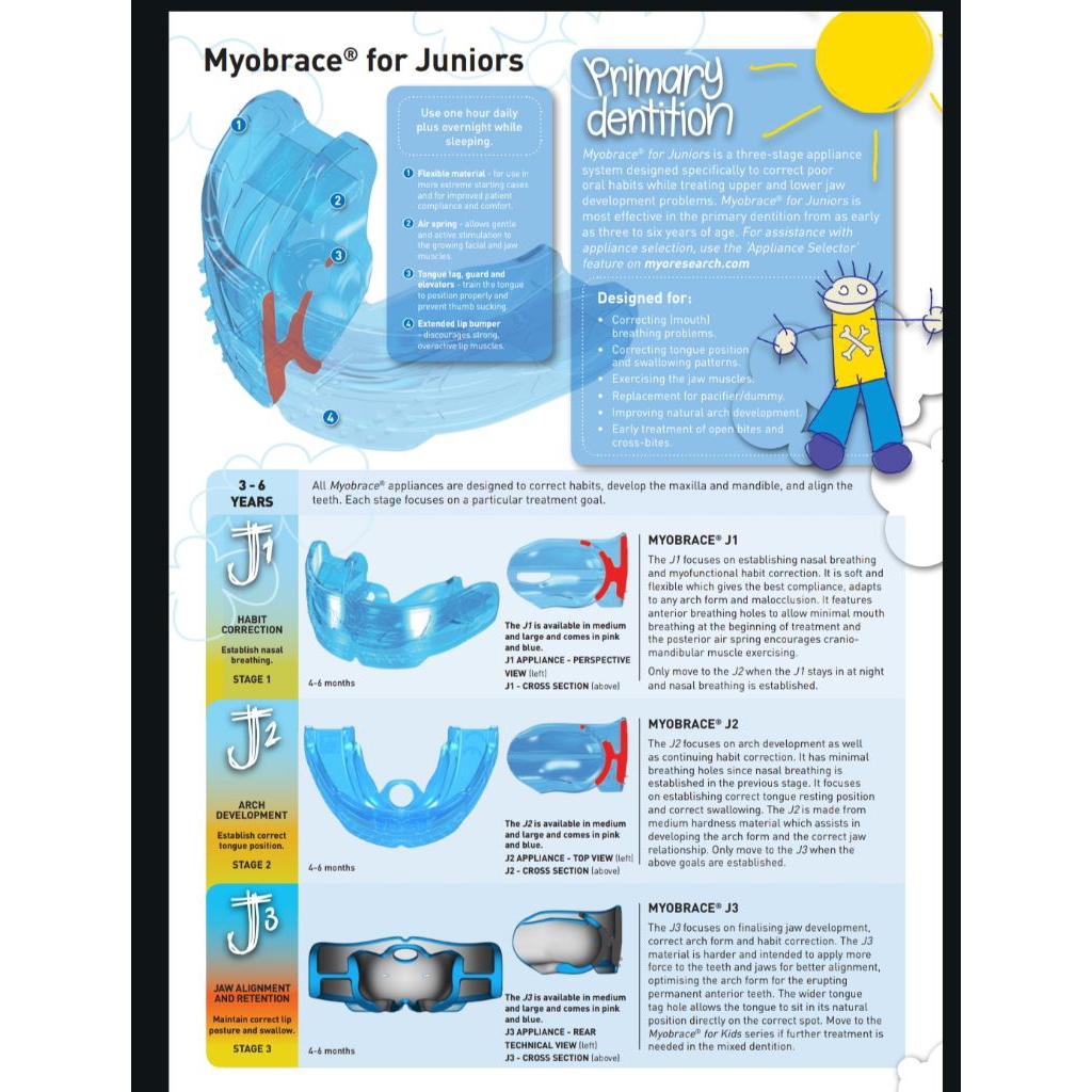 myobrace J1 (junior) untuk anak usia 3 sampai 6 tahun awal