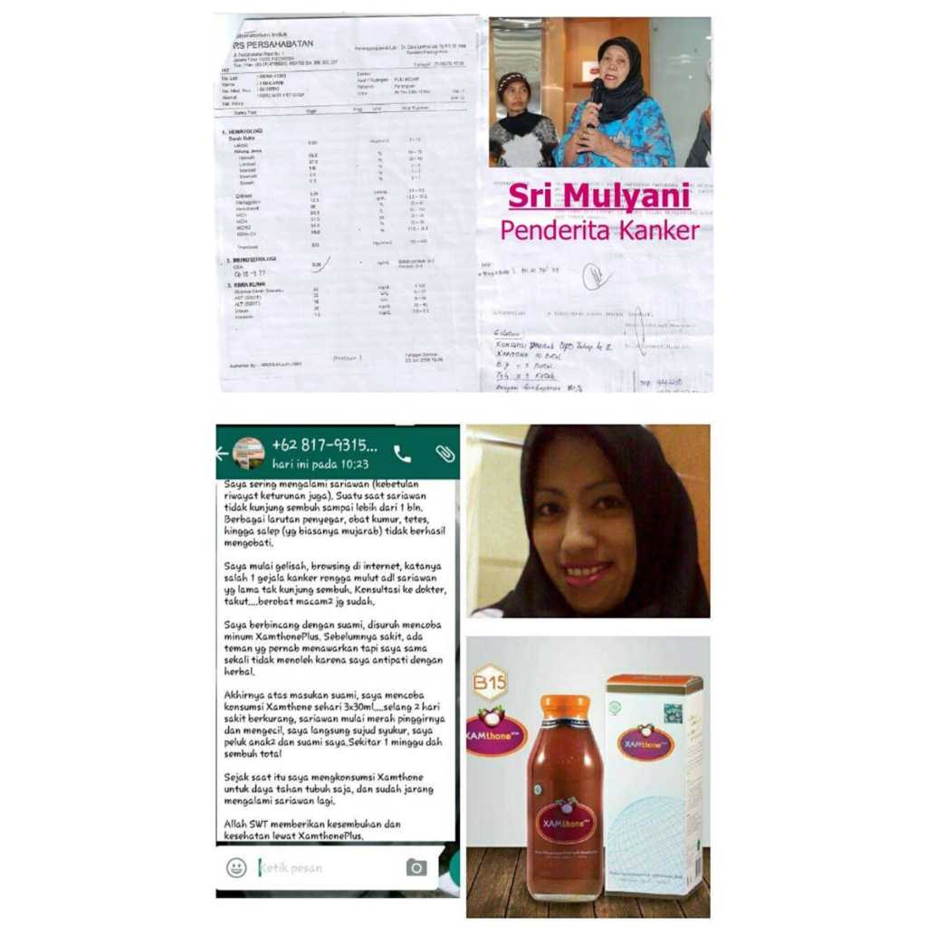 

Obat Herbal Miom | Paket 1 Bulan Konsumsi