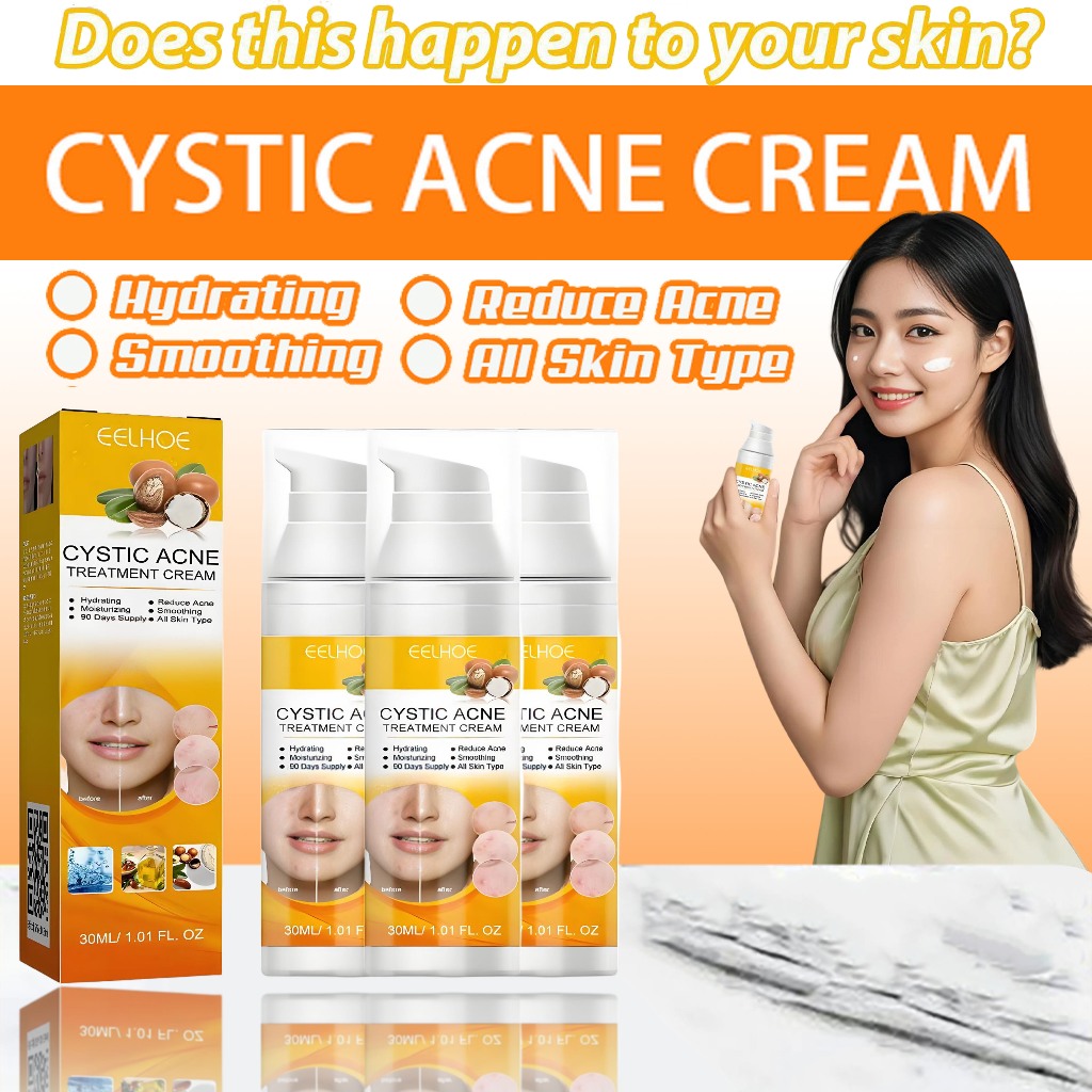 Obat Cina Jerawat Ampuh / Obat Cina Buat Jerawat - Salep jerawat paling ampuh penghilang jerawat dan