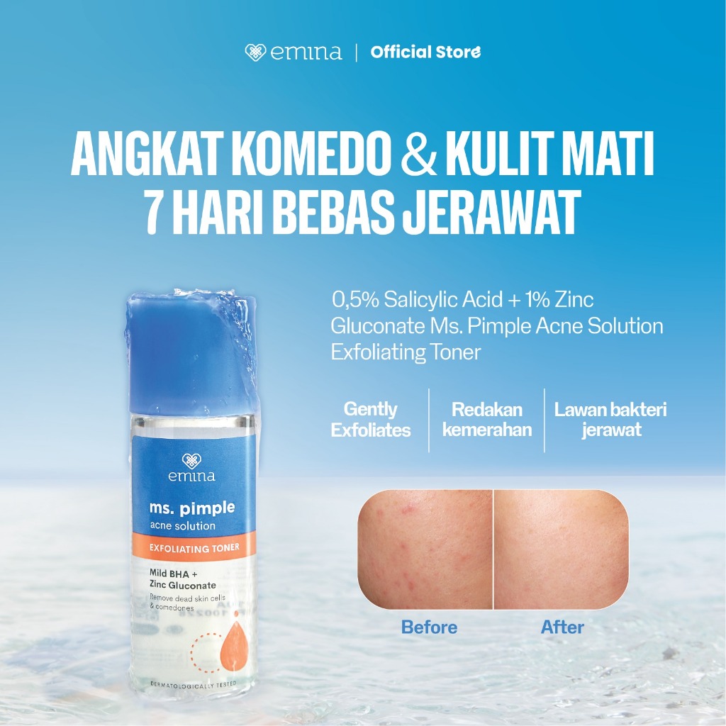 Emina Ms. Pimple Acne Solution Exfoliating Toner 100 mL - Angkat Sel Kulit Mati dan Komedo, Atasi Je
