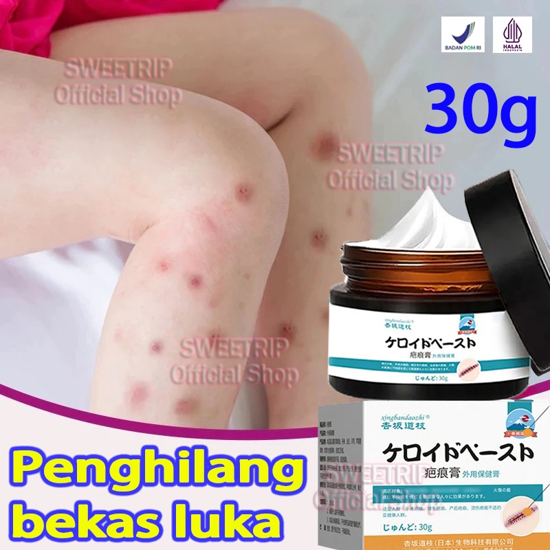 Penghilang bekas luka hitam koreng Penghilang bekas luka di kaki Penghilang Bekas cacar Bekas gigita