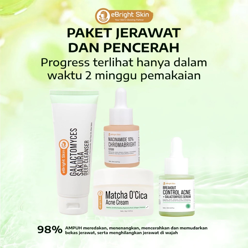 Acne Whitening Ultimate - eBright Skin Paket Jerawat dan Pencerah
