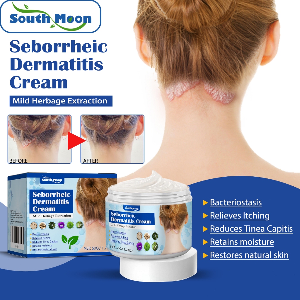 South Moon Seborrheic Dermatitis Cream 50g Krim Kulit Gatal Obat Kulit Kepala Psoriasis Dermatitis S