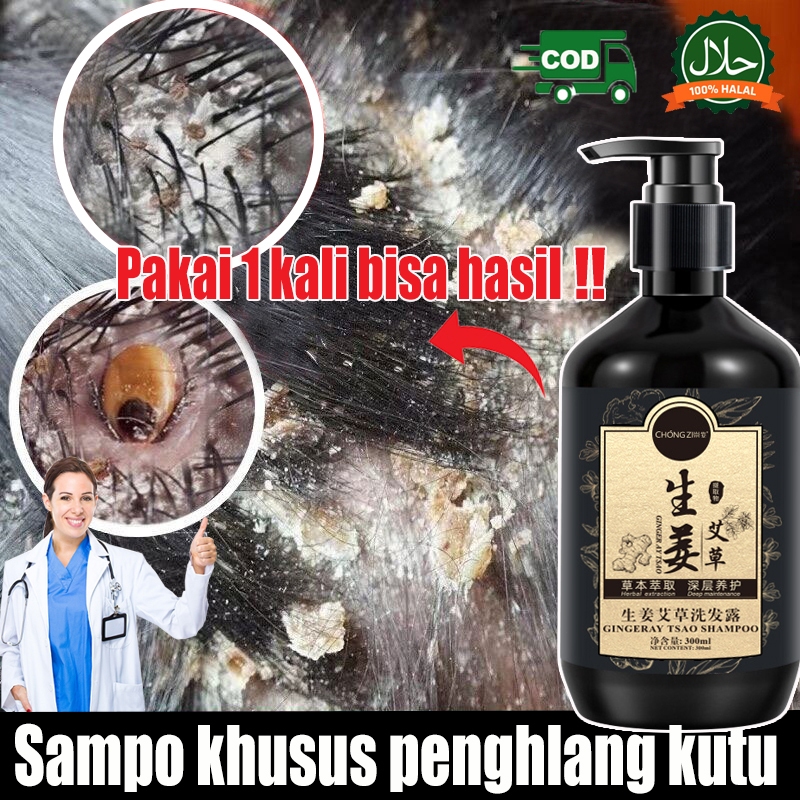 【ORI】shampoo kutu obat kutu rambut shampoo kutu rambut anak 300ml sampo anti gatal and ketombe mengh