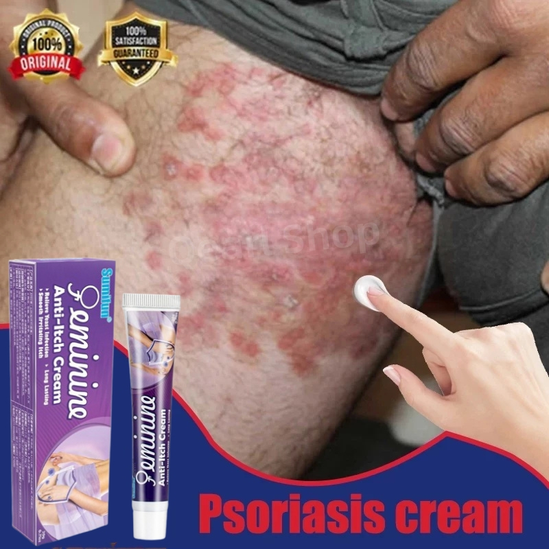 obat gatal selangkangan dan hitam salep eksim kering dan gatal salep jamur kulit paling ampuh psoria