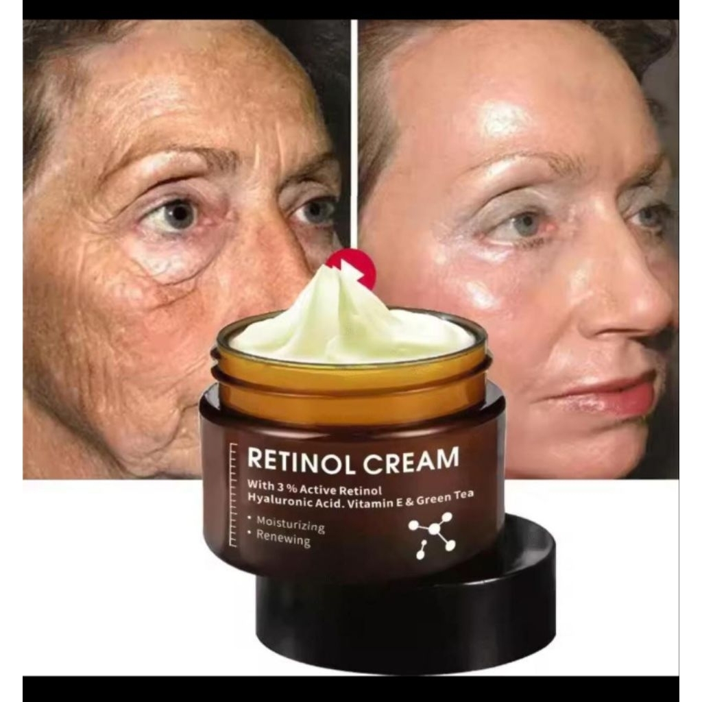 RETINOL buat awet muda, muka kendur, beruntusan, kantung mata
