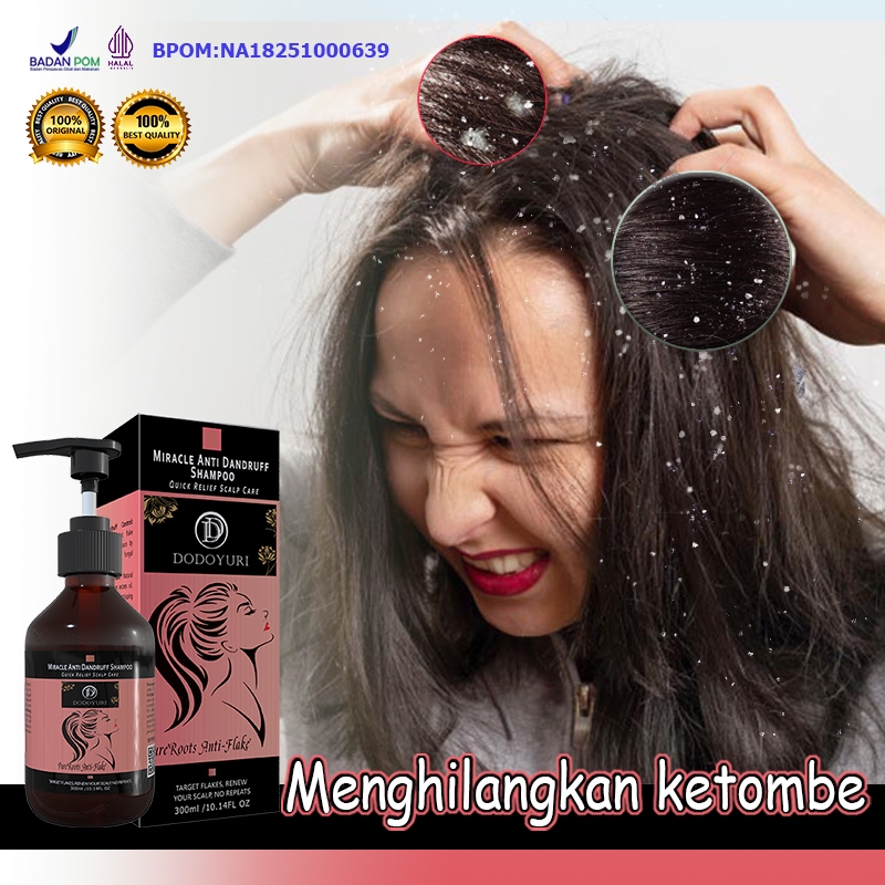 DODOYURI Sampo anti gatal and ketombe Shampoo anti ketombe  Sampo penghilang ketombe 300ml Penghilan