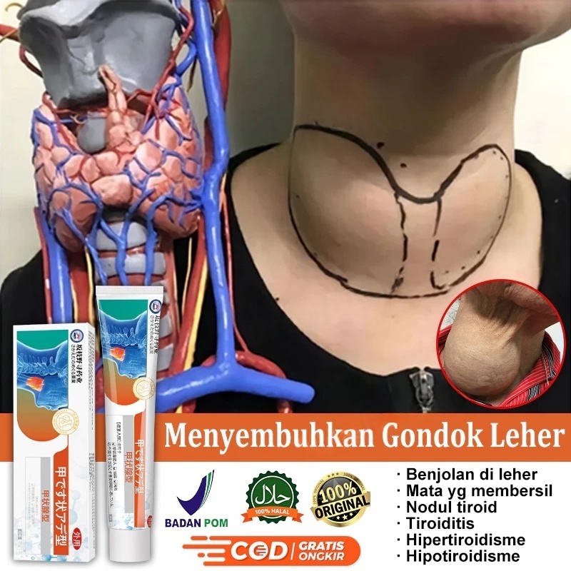 Obat tiroid Salep gondok paling ampuh Salep lipoma cream Salep benjolan di leher Efektif dan Aman