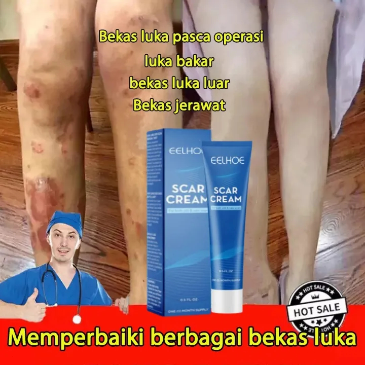 EELHOE Scar Removal Cream Penghilang Bekas Luka & Memperbaiki Barier Kulit Akibat Luka / Stretch Mar