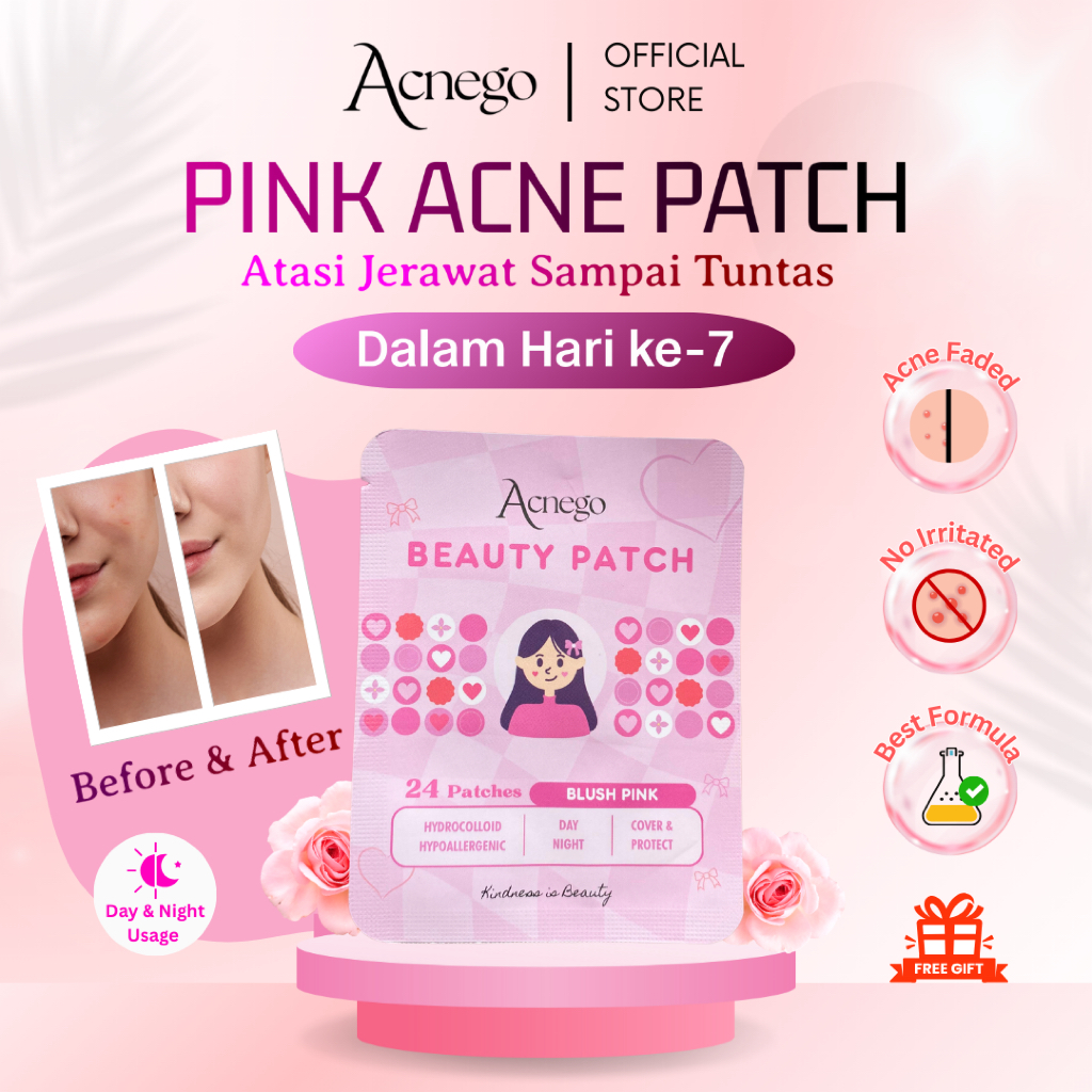 ACNEGO Acne Patch Blush Pink Acne Treatment - Plester Jerawat Merah muda Karakter Hati Love