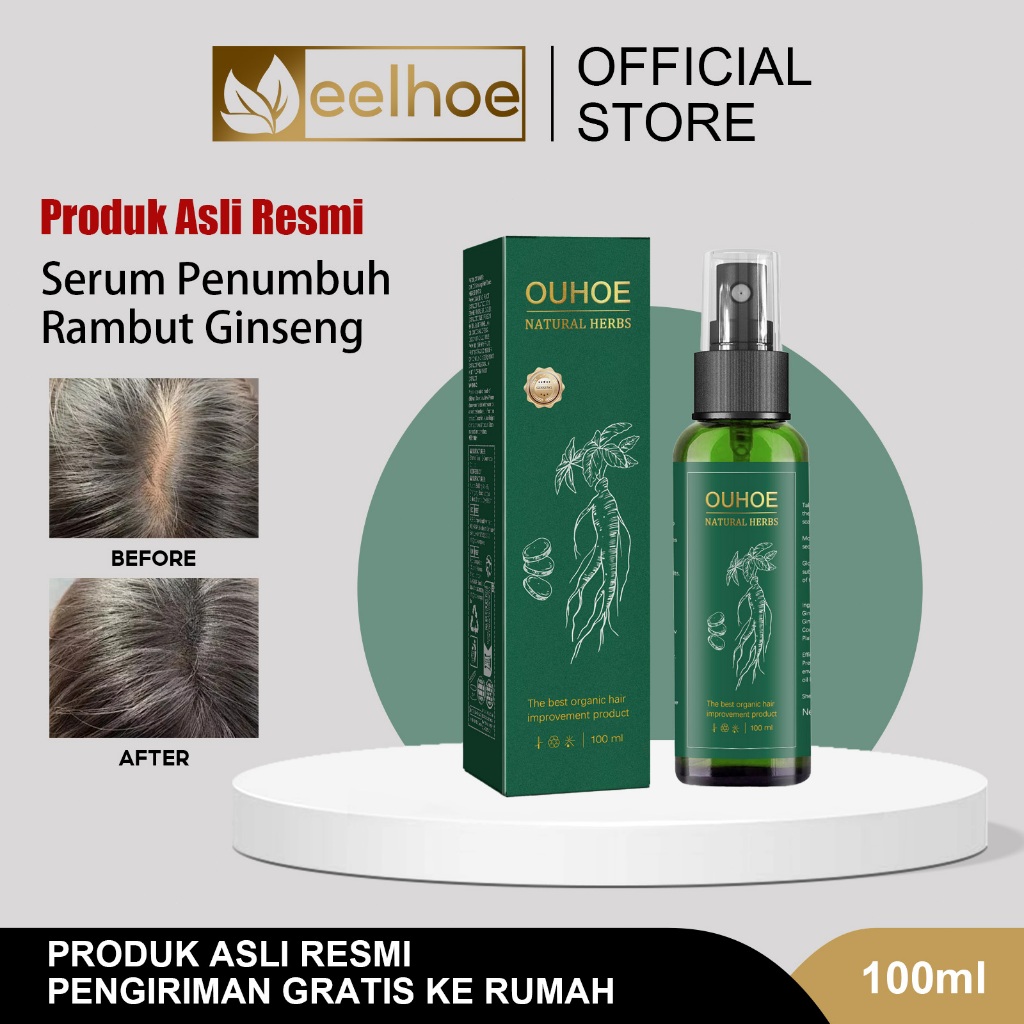 OUHOE Hair Tonic Ginseng Penumbuh Rambut 100ml Serum Penumbuh Rambut Ginseng Serum Penumbuh Rambut C