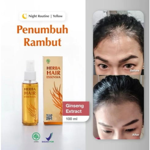 Hair Tonic Essential Yellow / Hair Tonic Essential Kuning