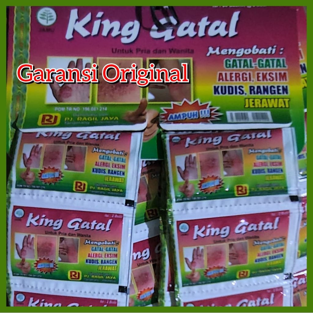 MANJUR MUJARAB KING GATAL EXIM ALERGI