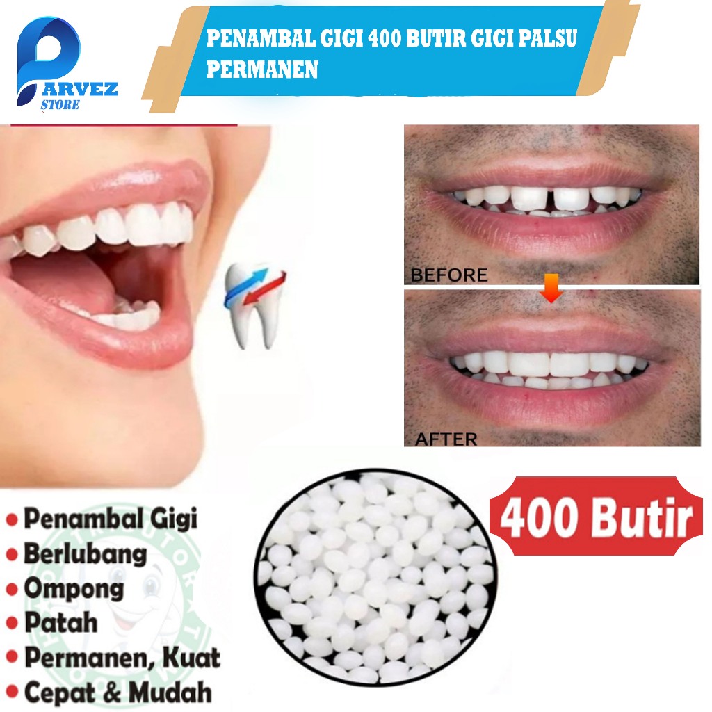 Penambal Gigi Berlubang Isi gigi palsu 400Butir TEMPTOOTH gigi berlubang Gigi palsu asli permanen