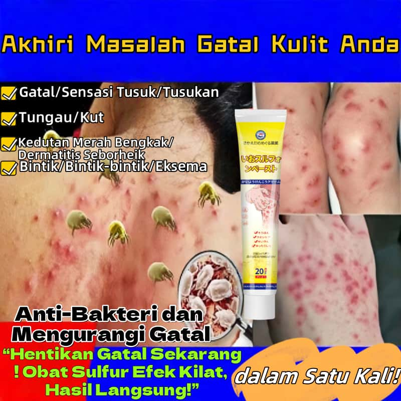 Obat Sulfur Mengurangi Gatal/Pengobatan Kulit/Anti-Bakteri/Mengurangi Gatal/Untuk Jerawat Dermatitis