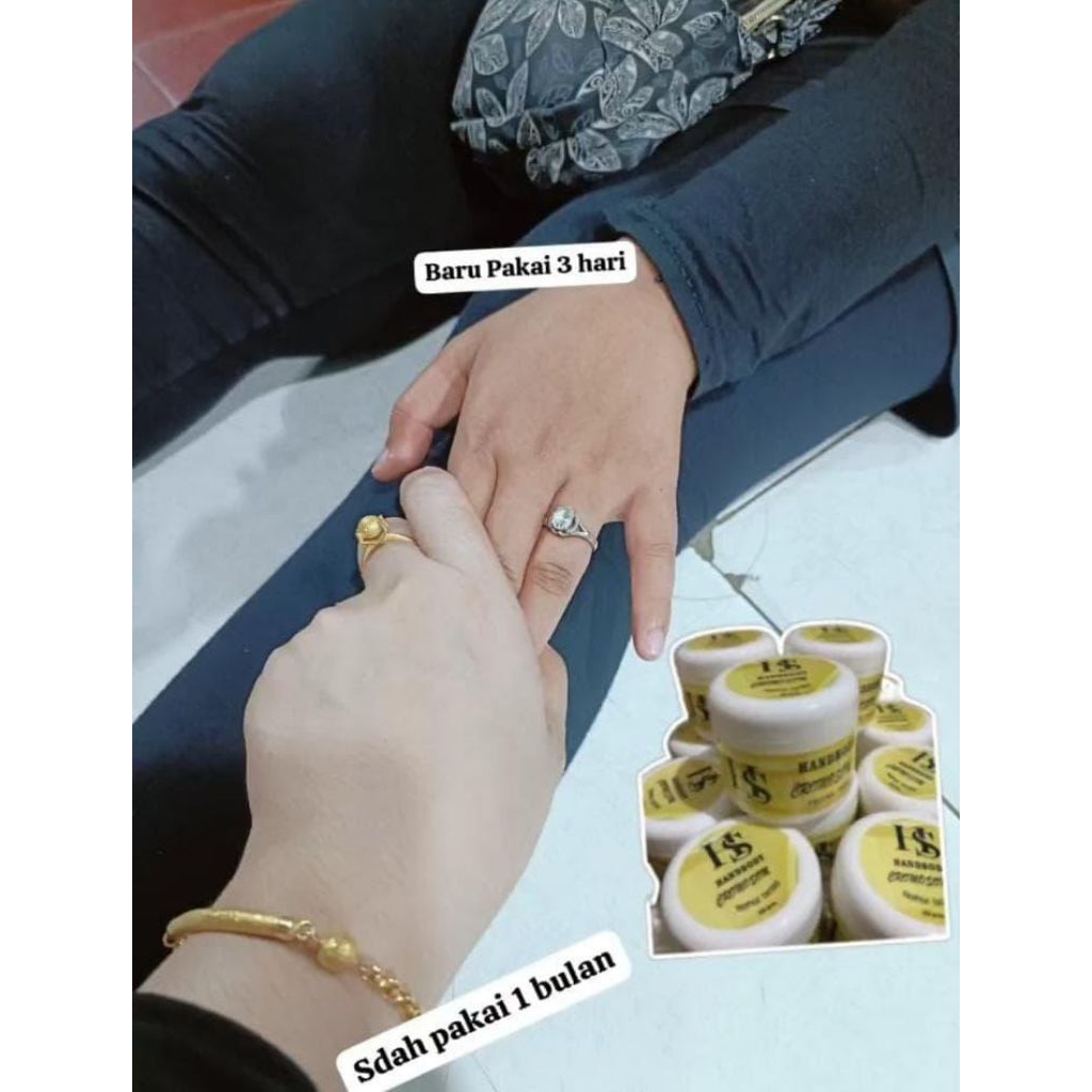 handbody hs cromosom