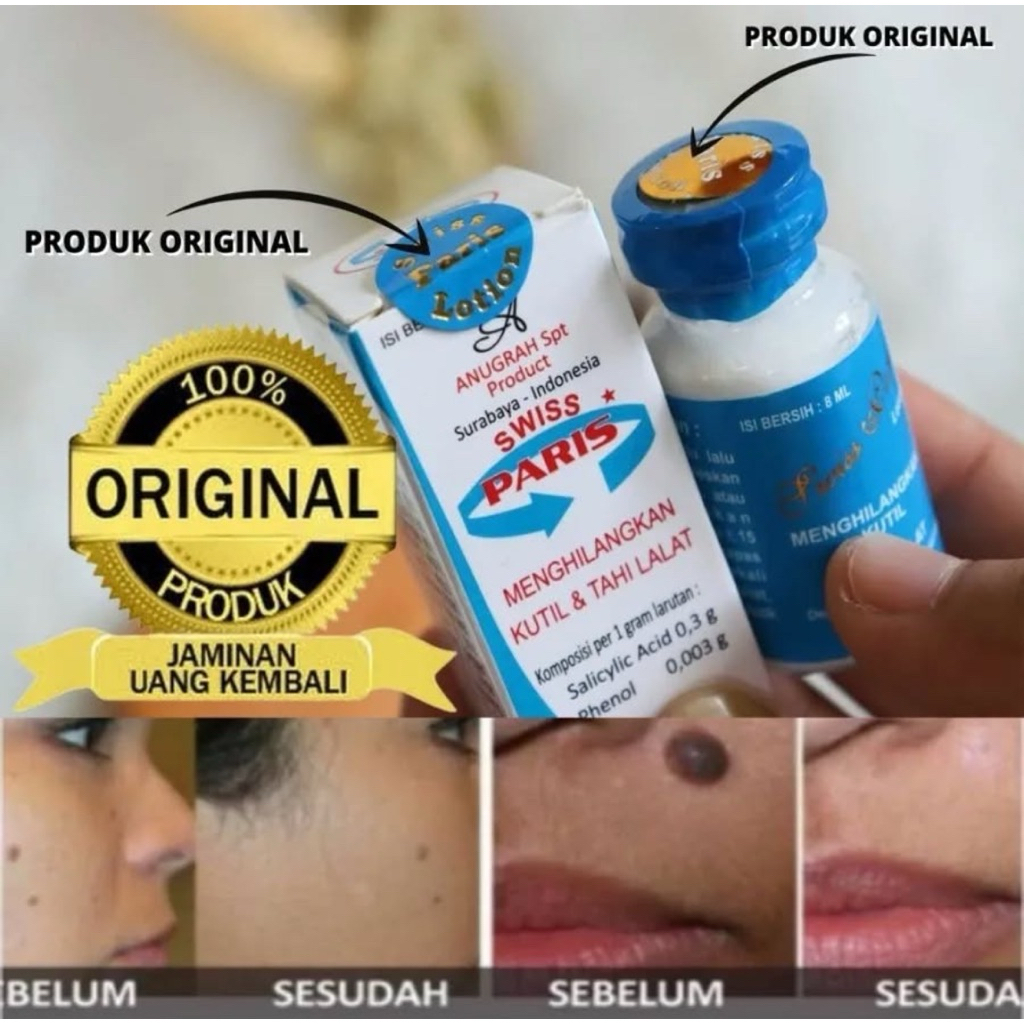 Lotion swiss paris penghilang kutil penghilang tailalat salep kutil salep mata ikan