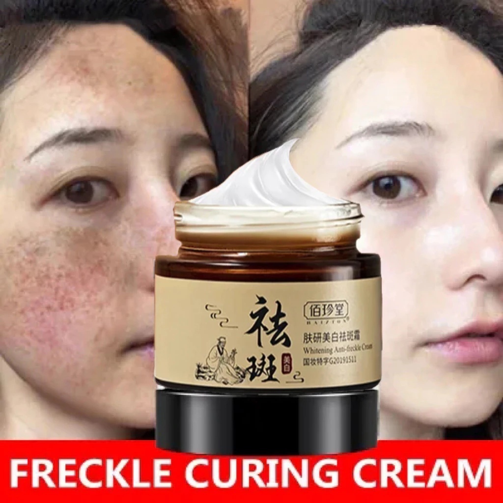 Cream Penghilang Flek Hitam Krim Penghilang Flek Hitam Cream Flek Hitam Membandel