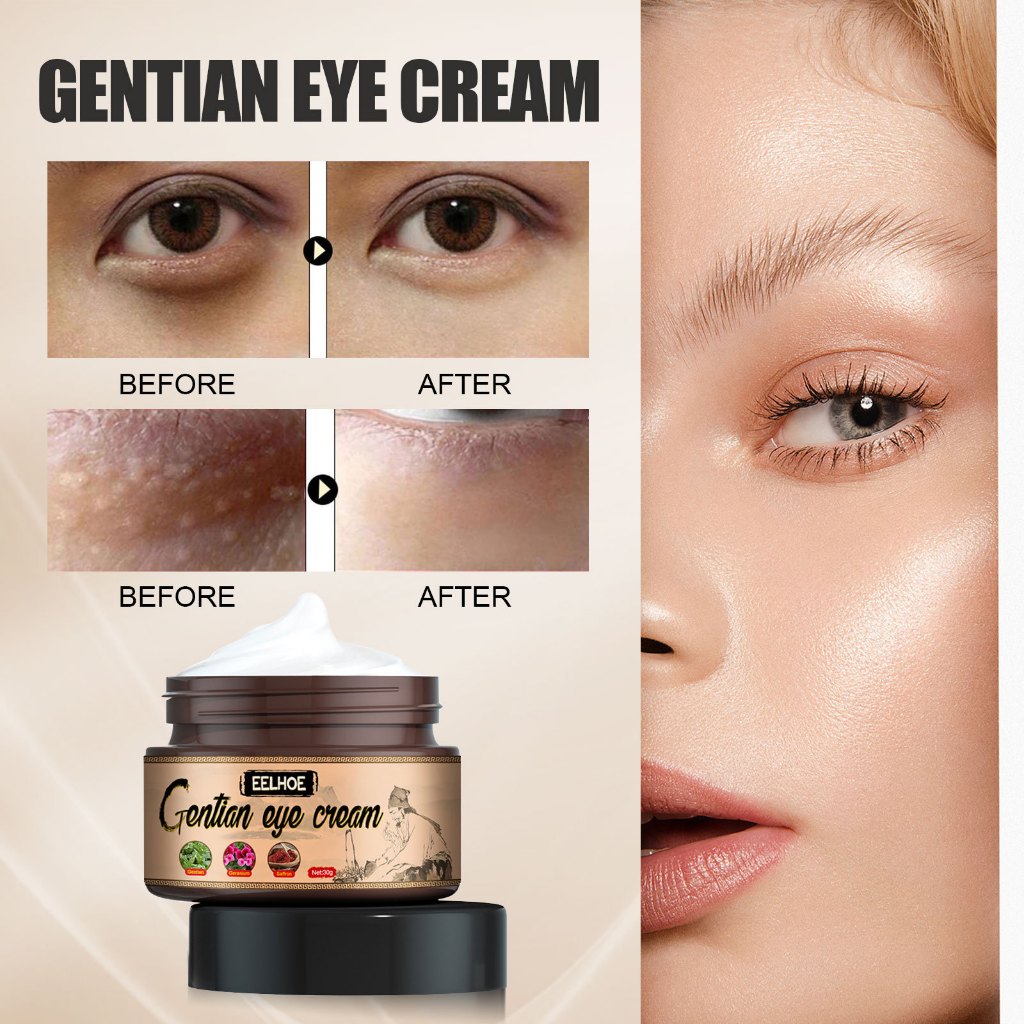 Fat Removing Granule Eye Cream 30g Krim Penghilang Gentian Eye Cream Lemak Menghapus Krim Soften Ker
