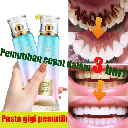 pemutih gigi odol pemutih gigi dan karang gigi 100g perontok karang gigi paling ampuh karang gigi pe