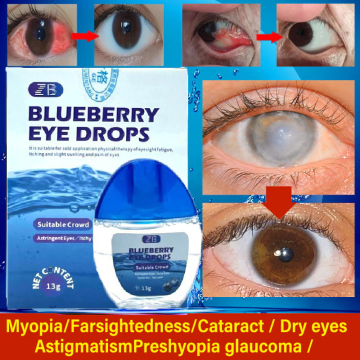13g Blueberry Eye Drops for Soothing Dry and Itchy Eyes