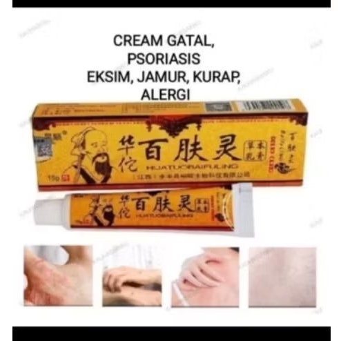 Salep Huatuobaifulling Salep Gatal Alergi Kurap