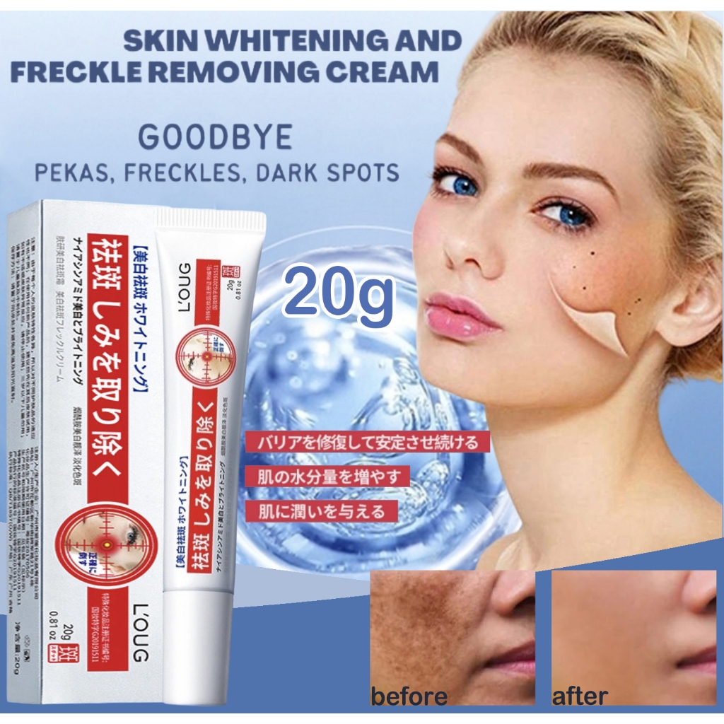 Whitening Freckle Cream Remove Dark Spots Anti Freckle Cream Niacinamide Fade Pigmentation Melasma B